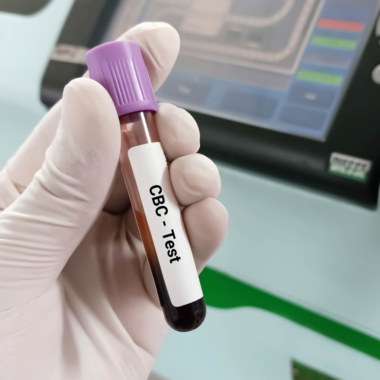 folia1 Etykieta na fiolce laboratoryjnej